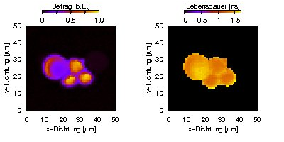 Foto: Fluoreszenzlebensdauer