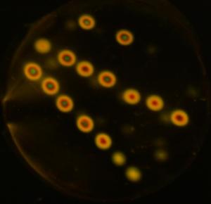 Abbildung: konfokale Fluoreszenzlebensdauer-Mikroskopie (FLIM)